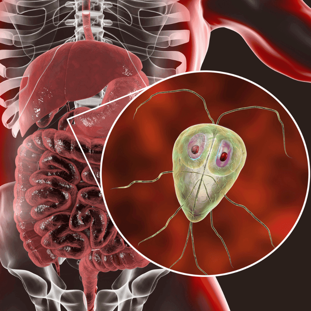 Giardia