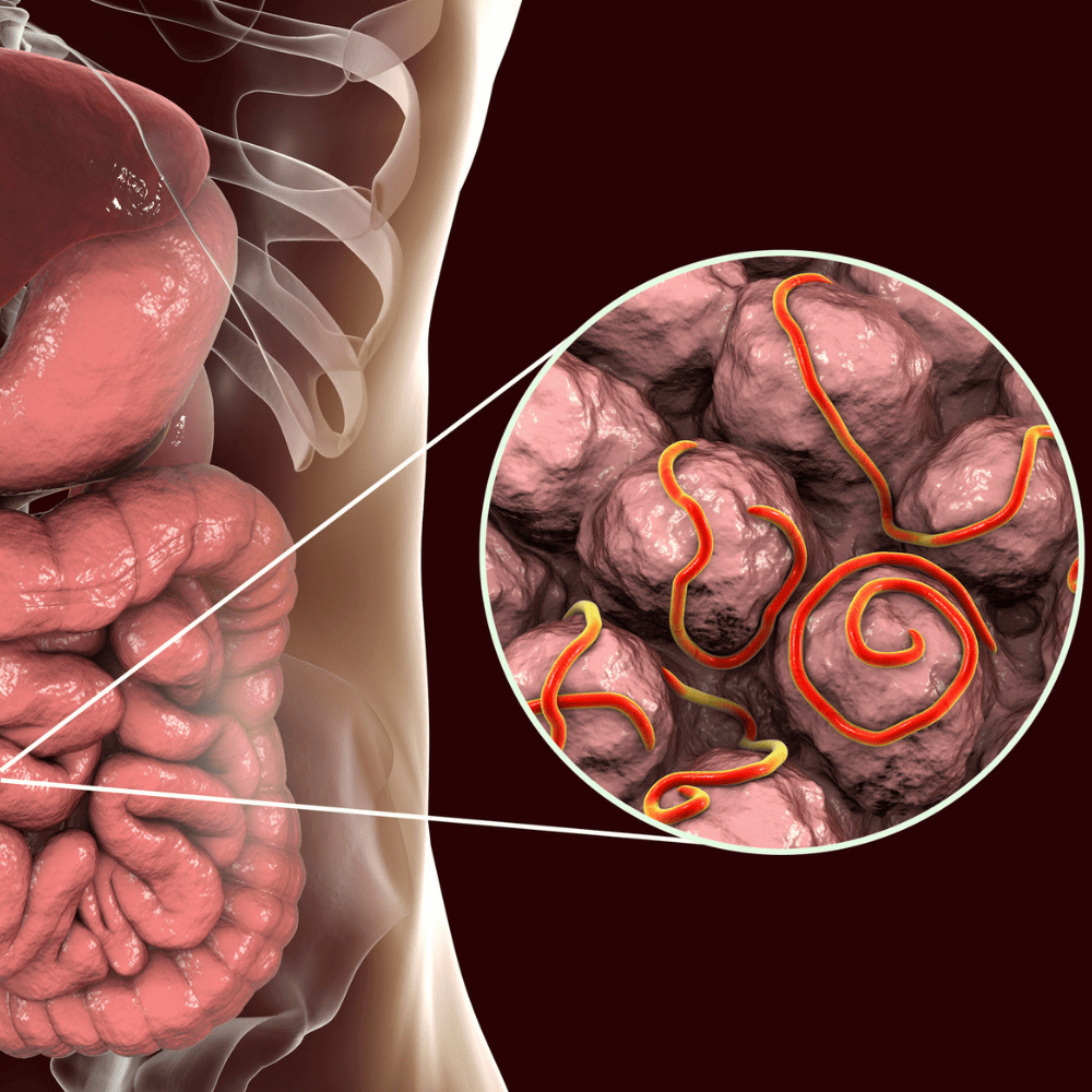 Signs You Might Have a Parasite Infection