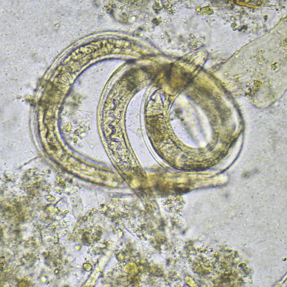 Strongyloides